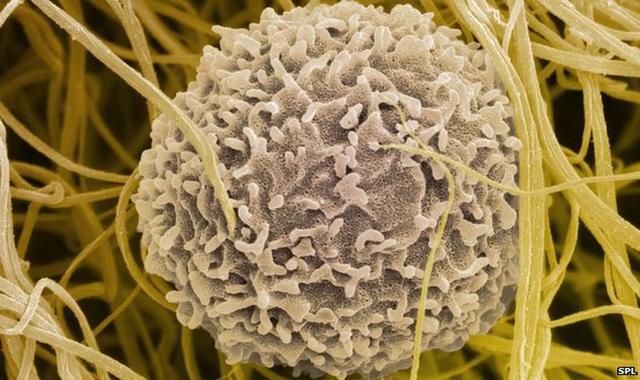 器官移植新突破  人类首次“种植”出完整生物器官